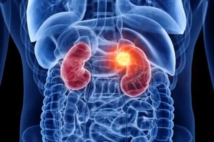 kidney : কিডনি রোগ - কারণ, লক্ষণ এবং চিকিৎসা !!