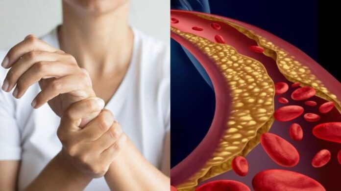 Cholesterol : কোলেস্টেরল বেড়েছে? অসহ্য ব্যথা দেহের এই অঙ্গগুলিতে !!