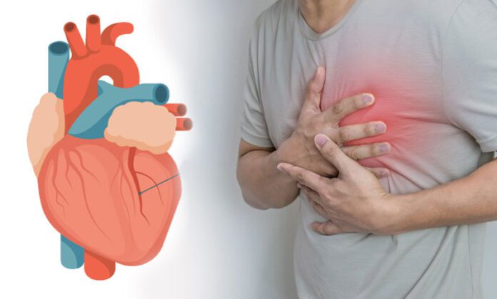 Heart Attack : প্রিয়জনের হার্ট অ্যাটাক -কী করবেন ?