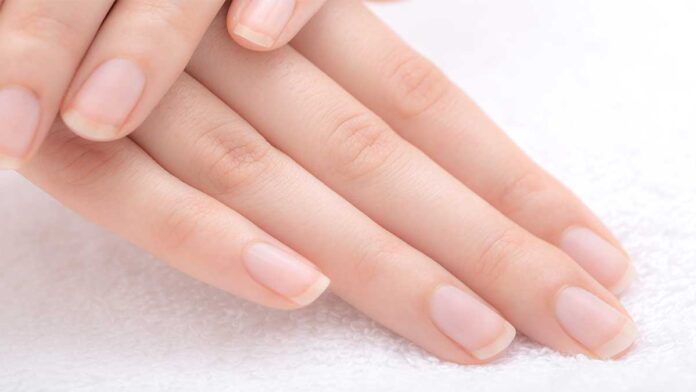 Nail Color | Nail color will tell the address of the disease?