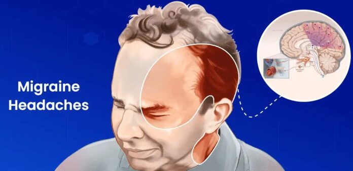 Migraine Attacks In Summer 5 Reasons