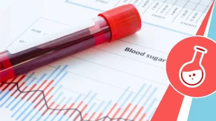 PP Sugar Test: কখন করাবেন ?