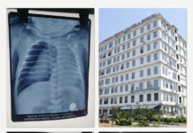 Santiniketan Medical College & Hospital:৩৪ সপ্তাহের অপরিণত নবজাতককে সংকটমুক্ত করতে জরুরি অস্ত্রোপচার!!!